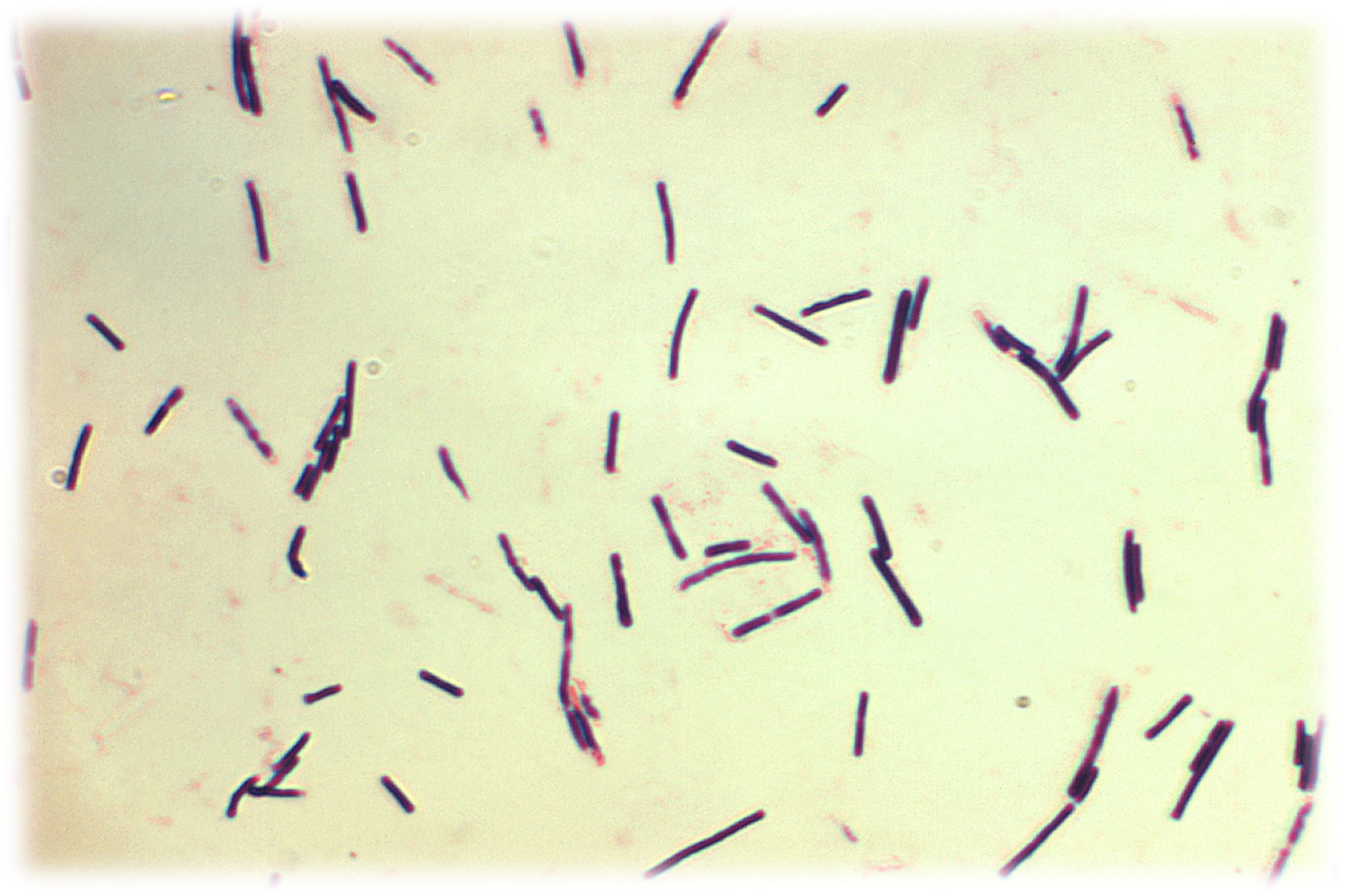 Clostridium perfringens