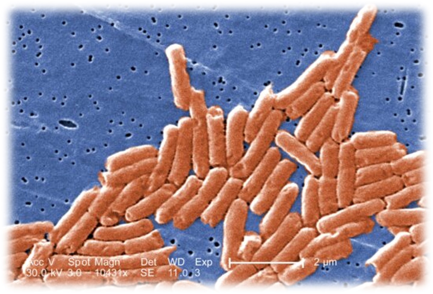 salmonellose