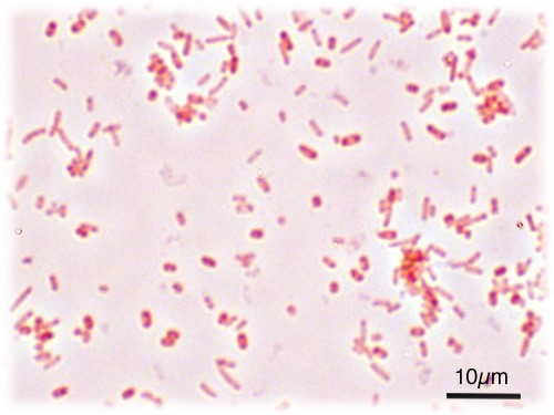 salmonella_typhimurium